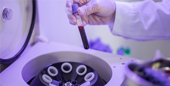 Application of Centrifuge in Clinical Diagnostic Laboratories